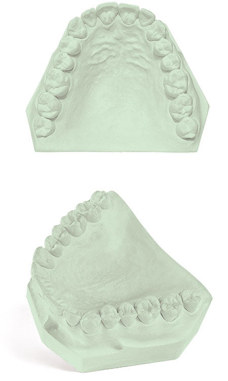 Garreco Veri-Die Type IV Die Stone, Green - Primehavenstore